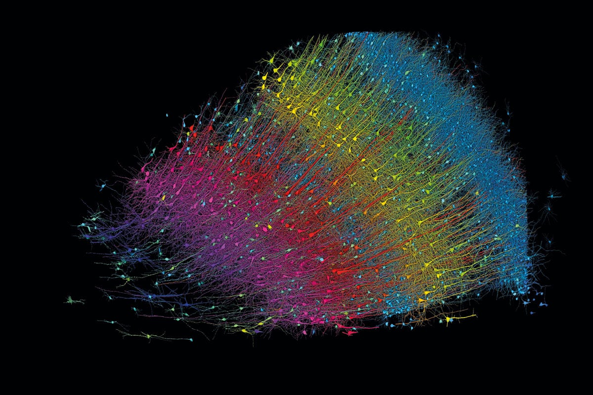 Sur fond noir, une multitude de très minces filaments colorés. Ils sont tellement nombreux qu'ils se chevauchent les uns les autres. De gauche à droite, on voit se succéder un amas de filaments fuchsia, puis rouges, jaunes et bleus. Les filaments sont orientés en diagonale vers le coin supérieur droit de l'image. Au bout de chaque filament, il y a un renflement.